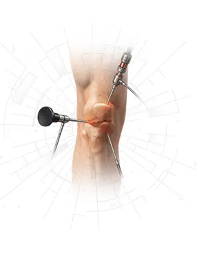 Knee Surgery