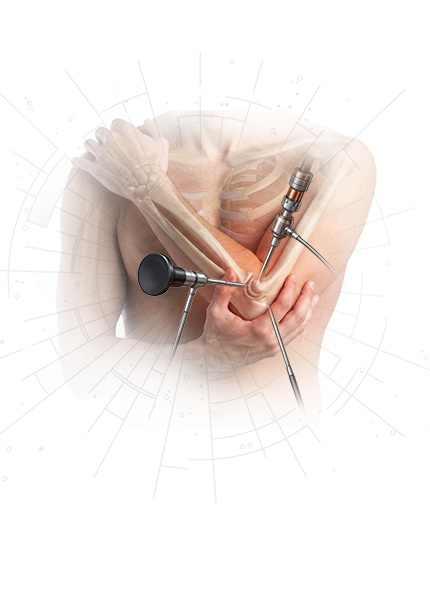 Elbow Surgery