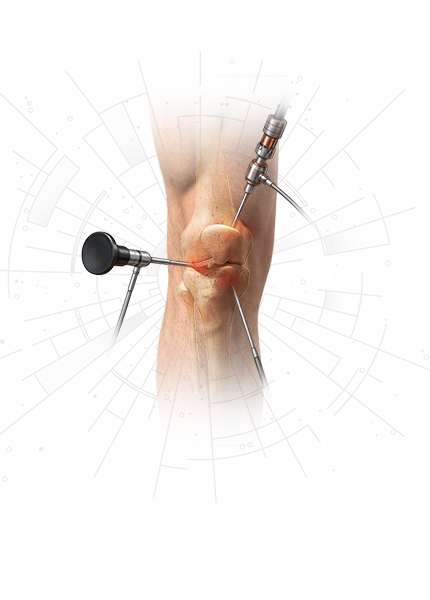 Knee Surgery